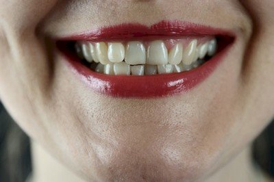 Nordjyske tænder smiler (h)vidt